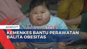Soal Balita Obesitas di Bekasi, Menkes: Kita Akan Observasi di Rumah Sakit