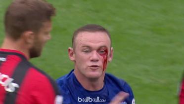 Rooney Disikut Sampai Wajah Berdarah, Protes ke Wasit