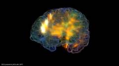 Visualisasi otak manusia
