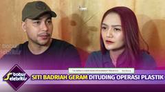 Siti Badriah Geram Dituding Lakukan Operasi Plastik - Status Selebritis