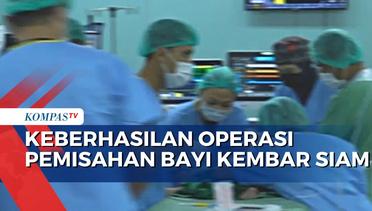 Operasi Pemisahan Bayi Kembar Siam di NTB Dinyatakan Sukses!
