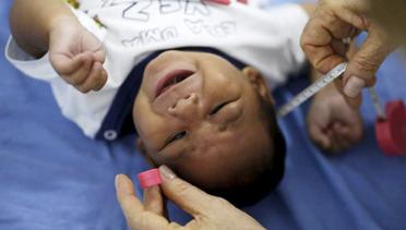 News Flash: Ditemukan Kelainan Pada Mata Bayi yang Terinfeksi Virus Zika