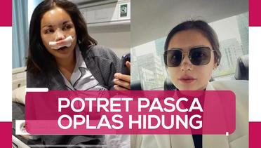 Simak Tampilan Terbaru Jessica Iskandar Pasca Oplas Hidung