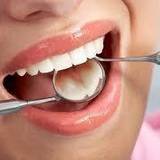 Tips Kesehatan Gigi Mulut