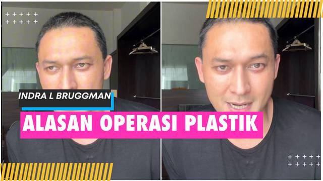 Indra L Bruggman Ungkap Alasan Lakukan Operasi Plastik di Korea Selatan