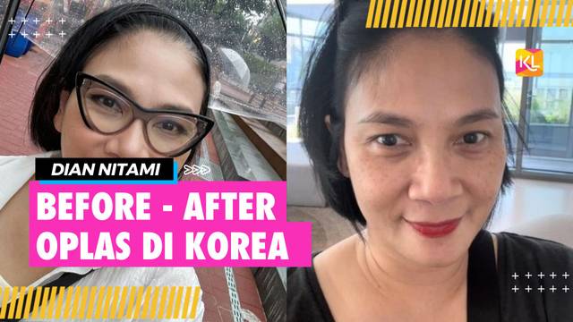 Potret Dian Nitami Pulang dari Oplas di Korea, Tampak Lebih Muda, Sudah Terlihat Meski Masih Memar