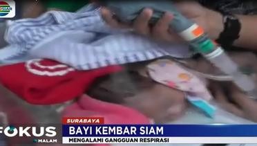 Bayi Kembar Siam asal Ternate Siap Jalani Pemisahan di RSUD dr Soetomo - Fokus Malam
