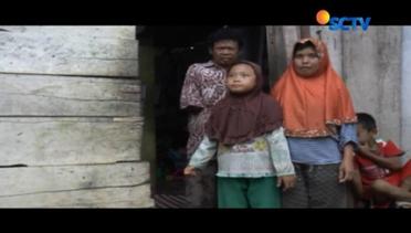 Potret Keluarga Miskin Asal Pagaralam Tinggal Numpang di Gubuk Reot – Liputan6 Pagi