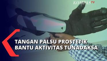 Start Up Binaan ITB, Karla Bionics Ciptakan Tangan Palsu Prostetik untuk Bantu Aktivitas Tunadaksa