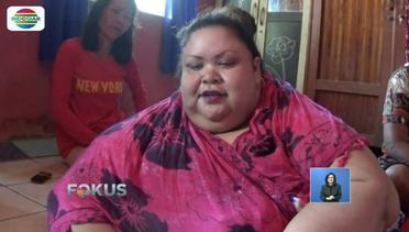 Derita Obesitas, Titi Wati Pilih Rawat di Rumah - Fokus