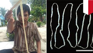 Cacing pita sepanjang 2,8 meter ditemukan di dalam tubuh pria ini! - TomoNews