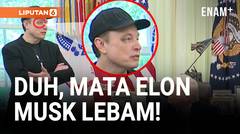 Elon Musk Muncul dengan Mata Lebam di Gedung Putih
