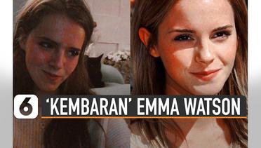 Ella Norton, 'Kembaran' Emma Watson yang Sulit Dibedakan