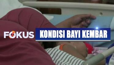 Usai Jalani Operasi, Kondisi Bayi Kembar di Surabaya Terus Membaik  - Fokus 