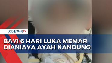 Bayi Baru Usai 6 Hari Dianiaya Ayah Kandung di Surabaya