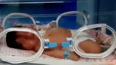 VIDEO: Ibu di China Lahirkan Bayi Raksasa Seberat 6,7 Kilogram