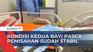 Kondisi Bayi Kembar Siam Aliyah-Aisyah Sudah Stabil, Perkembangan Motorik akan Diawasi Dokter