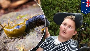 Remaja Ausie ini lumpuh setelah terima tantangan telan siput - TomoNews