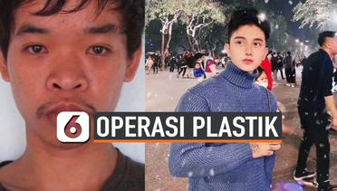 Pria Operasi Plastik Usai Ditolak Kerja, Perubahan Wajahnya Mengejutkan