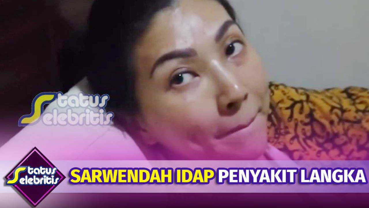 Sarwendah Lawan Penyakit Langka Rima Melati Berjuang Di Icu Status Selebriti Vidio