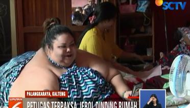Titi Wati Penderita Obesitas akan Ditangani 6 Dokter Ahli dari Bali - Liputan 6 Siang