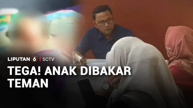Main Bersama, Seorang Anak 8 Tahun Diduga Dibakar Teman Sebaya | Liputan 6